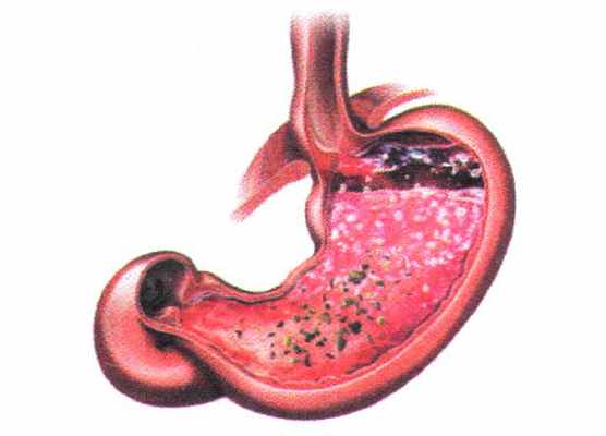 Кислотный карман здорового человека (Янова О.Б.)