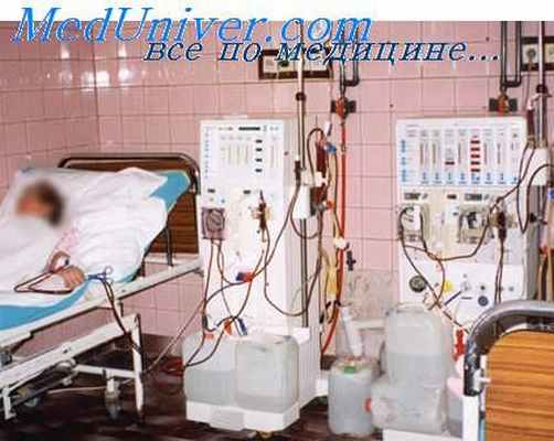 плазмаферез