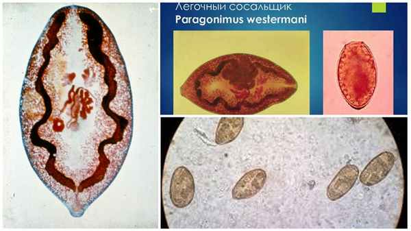 Легочная двуустка (сосальщик)