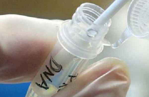 Пневмоцистоз, особенности, диагностика