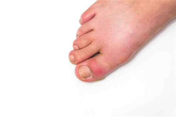 Большой палец.jpg