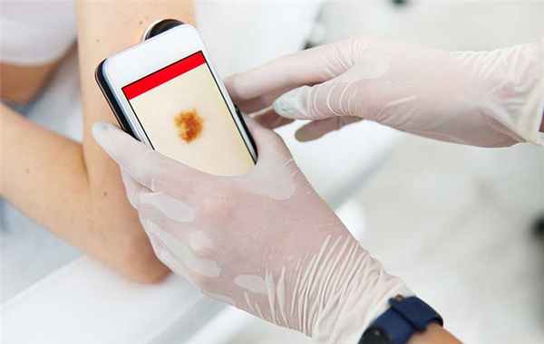 Доброкачественные образования подкожной жировой клетчатки