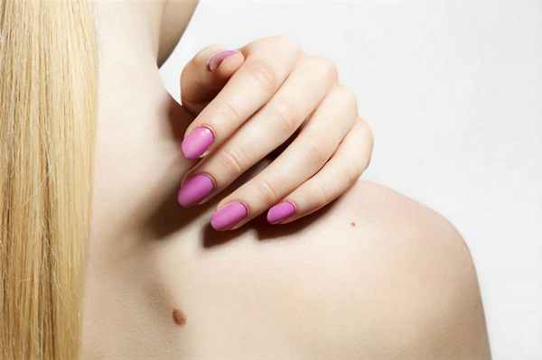 Причины образования красных родинок