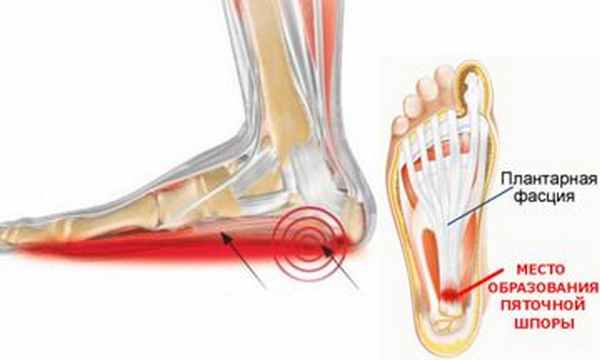 7002AE93-8FE6-4C9F-9483-F61B13BF6EB9-1357-000000ABB1B056B8