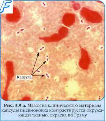 Подвижность бактерий. Скользящие бактерии. Плавающие бактерии. Аэробные бактерии. Анаэробные бактерии. Факультативные бактерии.
