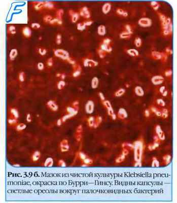 Подвижность бактерий. Скользящие бактерии. Плавающие бактерии. Аэробные бактерии. Анаэробные бактерии. Факультативные бактерии.
