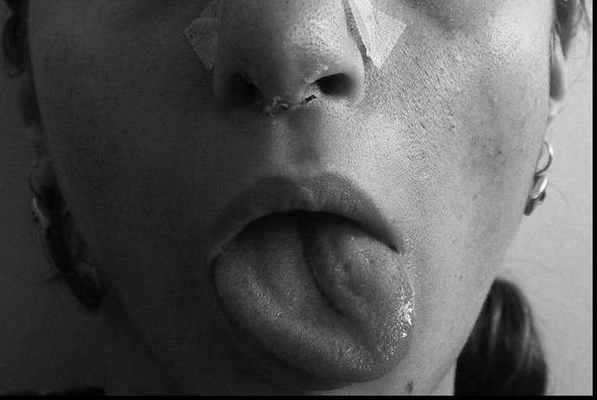 челюстно подъязычный нерв