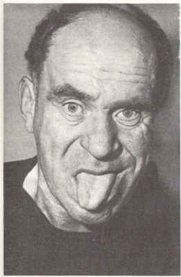 поражение подъязычного нерва