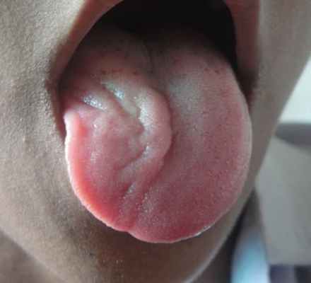 Подъязычный нерв