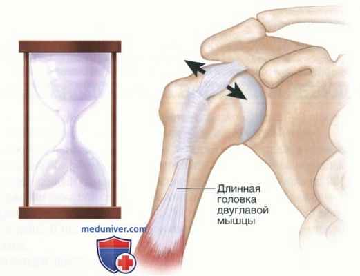 Операция артроскопический бицепс-тенодез