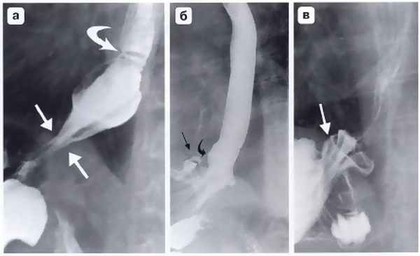 Рис. 5. Рентгенограмма.