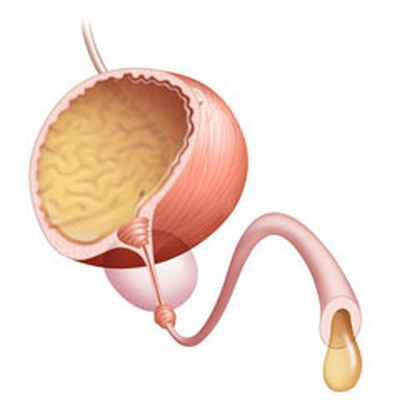 Лечение полиурии