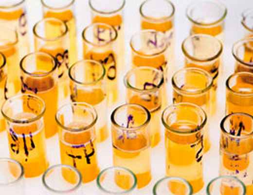 Диагностика полиурии в клиниках