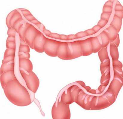 поперечная ободочная кишка