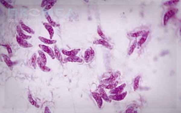 Лечение токсоплазмоза глаза