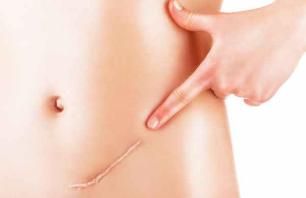 Обычная хирургия.jpg