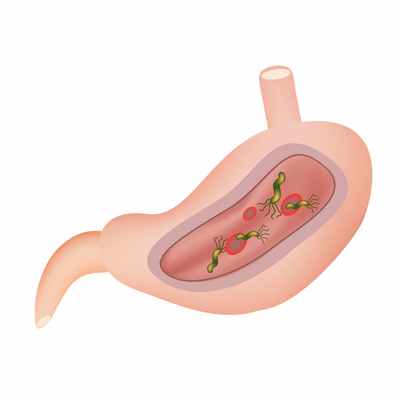 Бактерия Helicobacter pillory.jpg