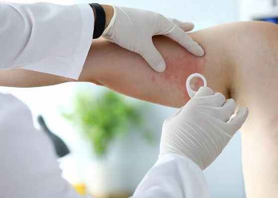 Диагностика потницы у взрослых