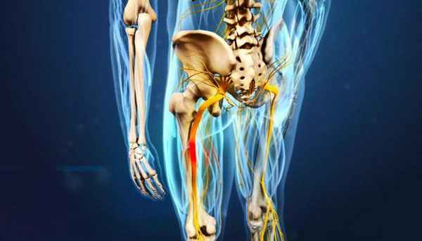 МРТ пояснично крестцового сплетения