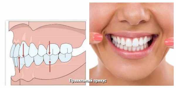 Правильный прикус зубов