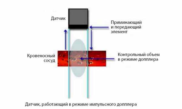 Импульсный допплер