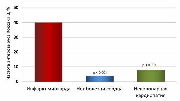 Вирусы Коксаки В при инфаркте миокарда