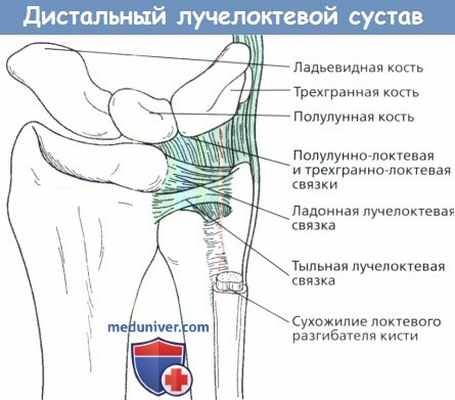 Дистальный лучелоктевой сустав