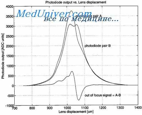 незаращение межпредсердной перегородки