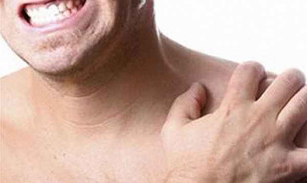 Фото Перелом ключицы