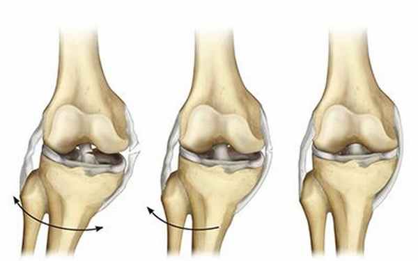 Связки надколенника - лечение травм связок колена