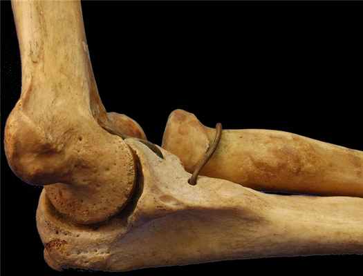 локтевой сустав человека