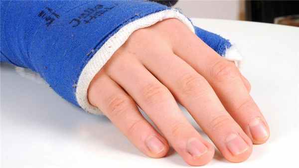 Вывих кисти руки