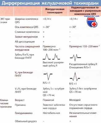 Дифференциация желудочковой тахикардии