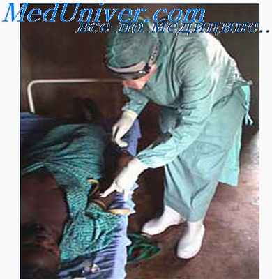 профилактика глпс