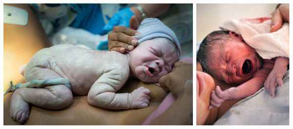 Внешний вид переношенных младенцев