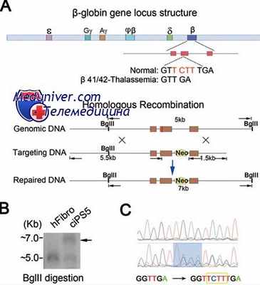 талассемия