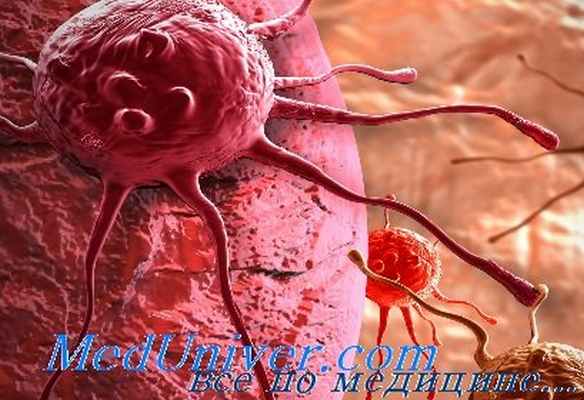 профилирование экспрессии генов опухоли