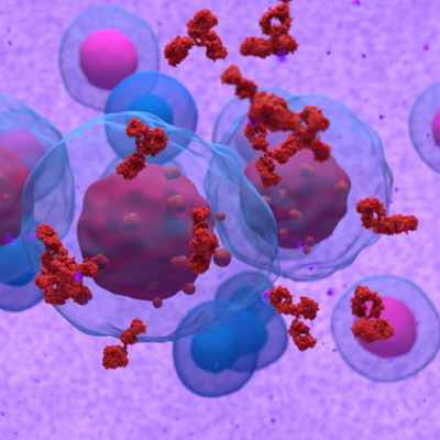 Множественная миелома