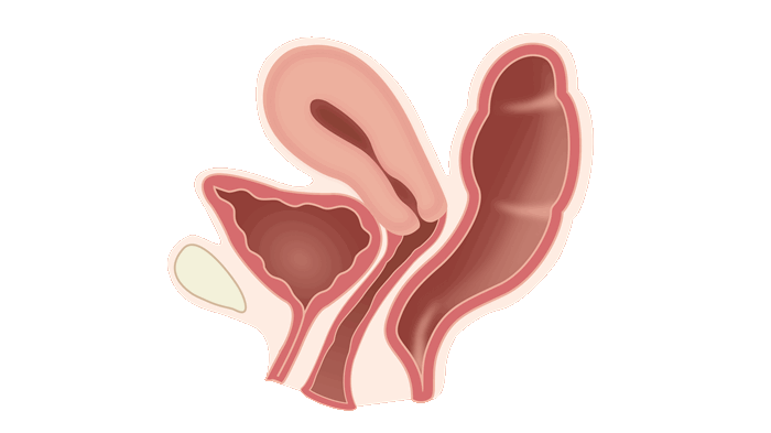 Опущение и выпадение органов малого таза: симптомы, лечение, операция