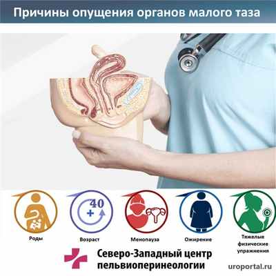 Причины ПТО