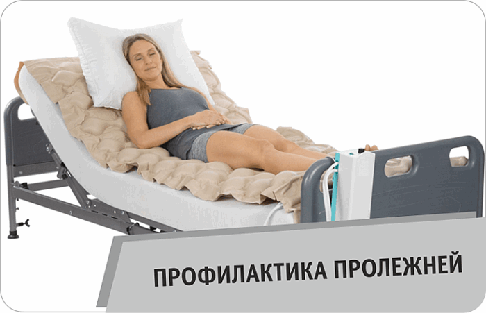 Пролежни: как предотвратить и как лечить