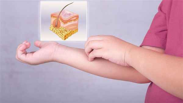 Мужчина чешет руку