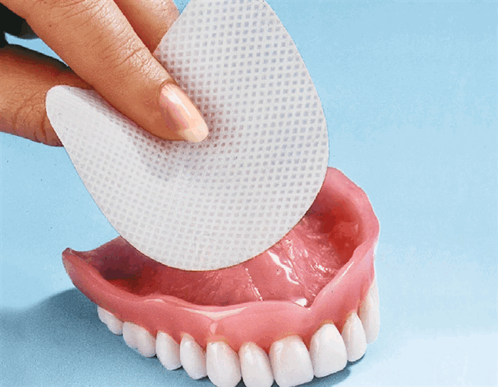 Фиксация прокладки на съемную челюсть