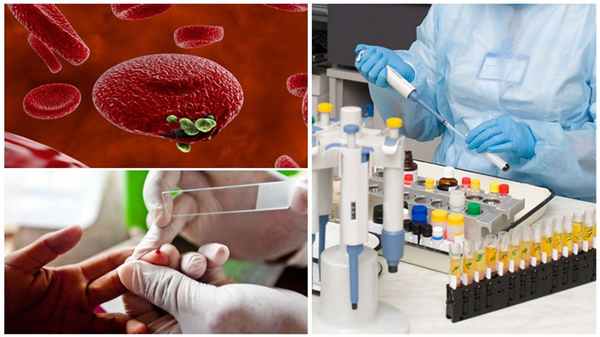 Диагностика малярии