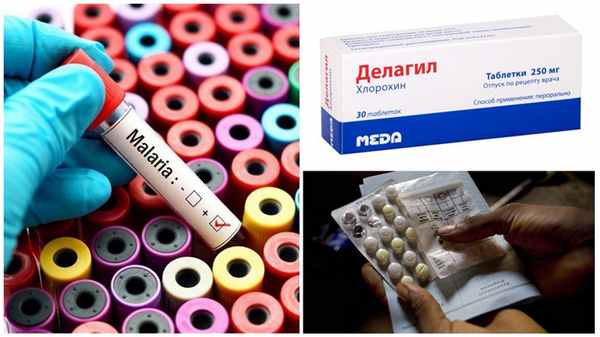 Лечение малярии