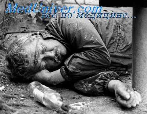 алкогольное опьянение