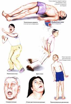 Неэпилептические припадки