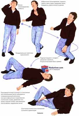 Неэпилептические припадки