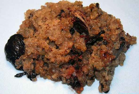 Ткани пузырного заноса