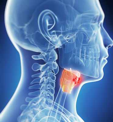 Причины рака горла (гортани)
